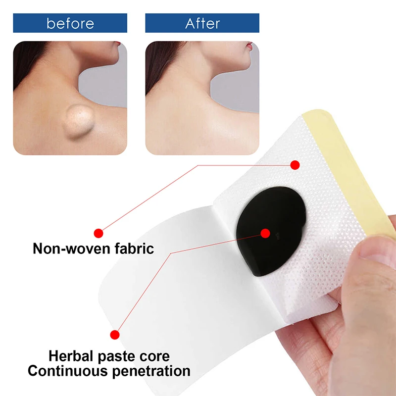 Lipoma Removal Cream 12pcs/20g Antitumor Remove Fat Lump Ointment Nodular Discomfort Skin Cyst Swelling Pain Relief Plaster