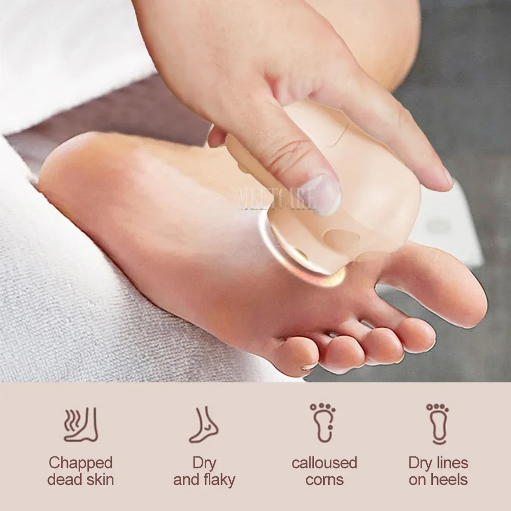 Mini Electric Pedicure Foot Grinder with LED Dry Peel USB Charging 3 Grinding Wheel Waterproof Foot Exfoliating Calluses Tool 3
