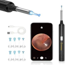 

VITCOCO Ear Wax Removal, Wireless Ear Cleaner with 1296P HD Ear Camera and 3.9mm Ear Otoscope, Earwax Removal Tool