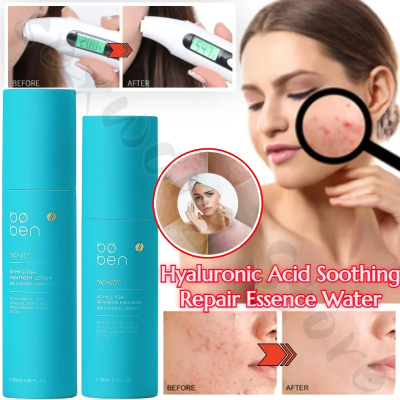 

6D Hyaluronic Acid Toner, Lotion, Essence, Hydrating, Moisturizing, Soothing, Repairing, Acne Removing, Sensitive Skin Essence