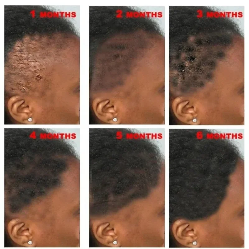Natural 100% Pure Batana Oil Butter Hair Mask Anti Break Loss Hair Growth From Honduras Loss Treatment for Black Men Women hair mask