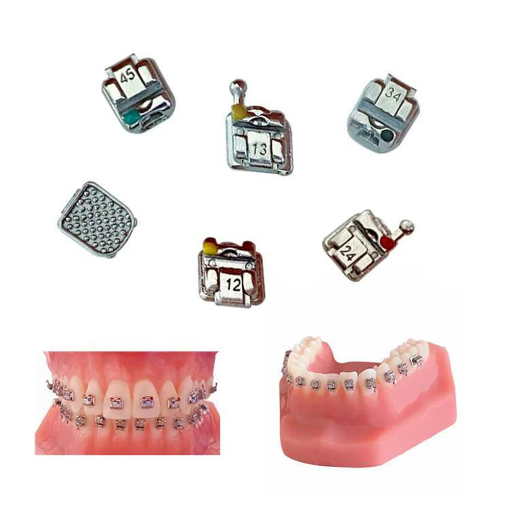 Supports Orthodontiques Auto-ligaturants Passifs ROTH/MBT - Taille 0.022, Crochet 3/345 - Neufs
