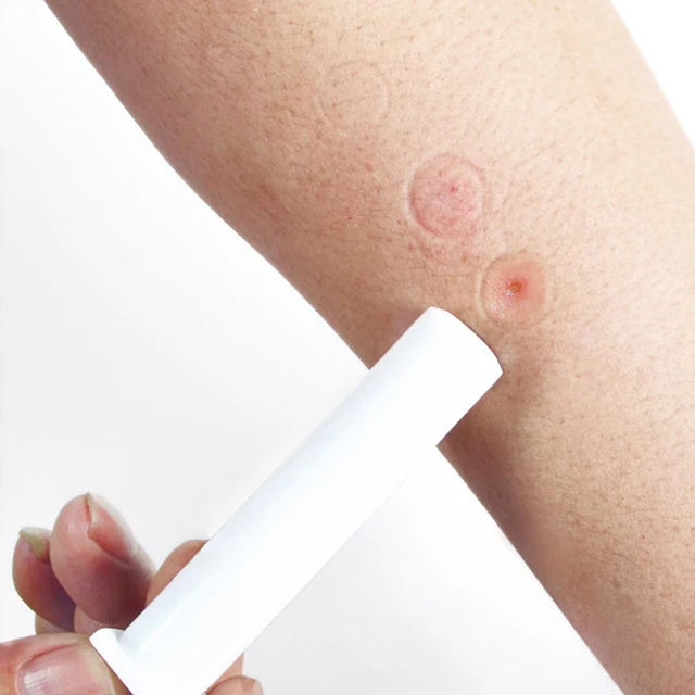 Venom Extractor Szívószivattyú Kígyó Szúnyog Harapás Kültéri Kemping Biztonsági Eszközök - Image 6