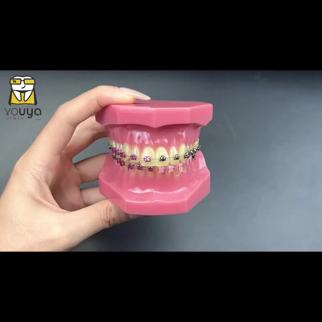 歯科歯模型矯正模型ブラケット付き 1/4 球形セルフロック式教育研究用