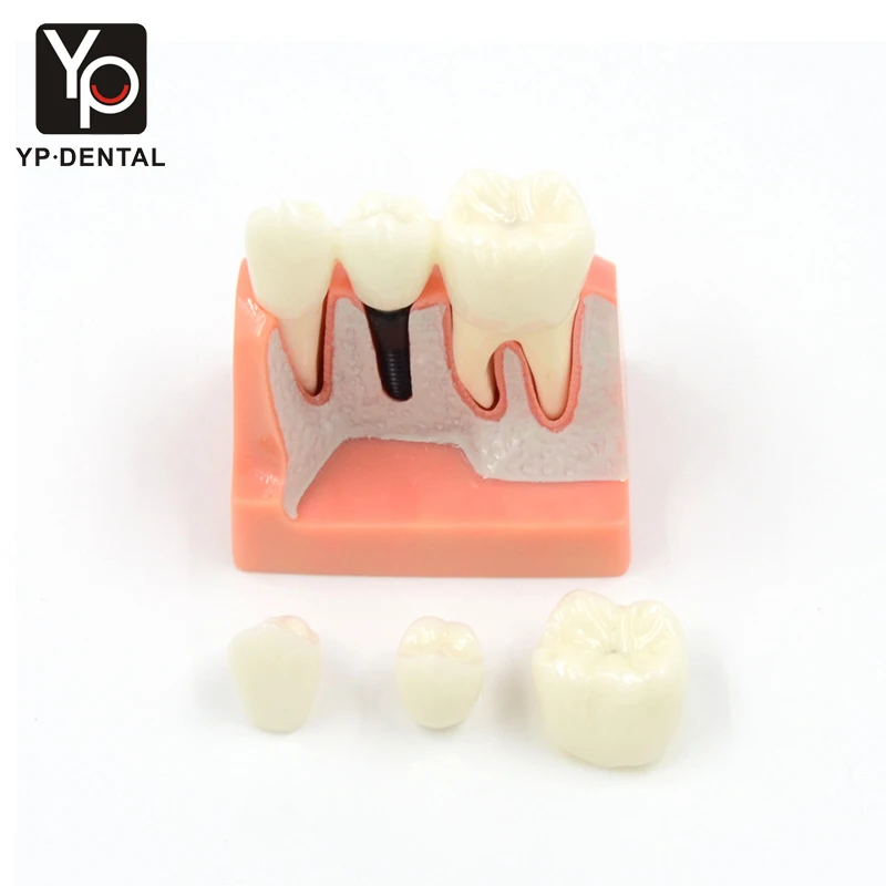 치과 모형, 레진 9.5x6.5x5cm, 치아 교육용, 학습용 치아, PVC 치과 교육 도구, 해부학 시연용