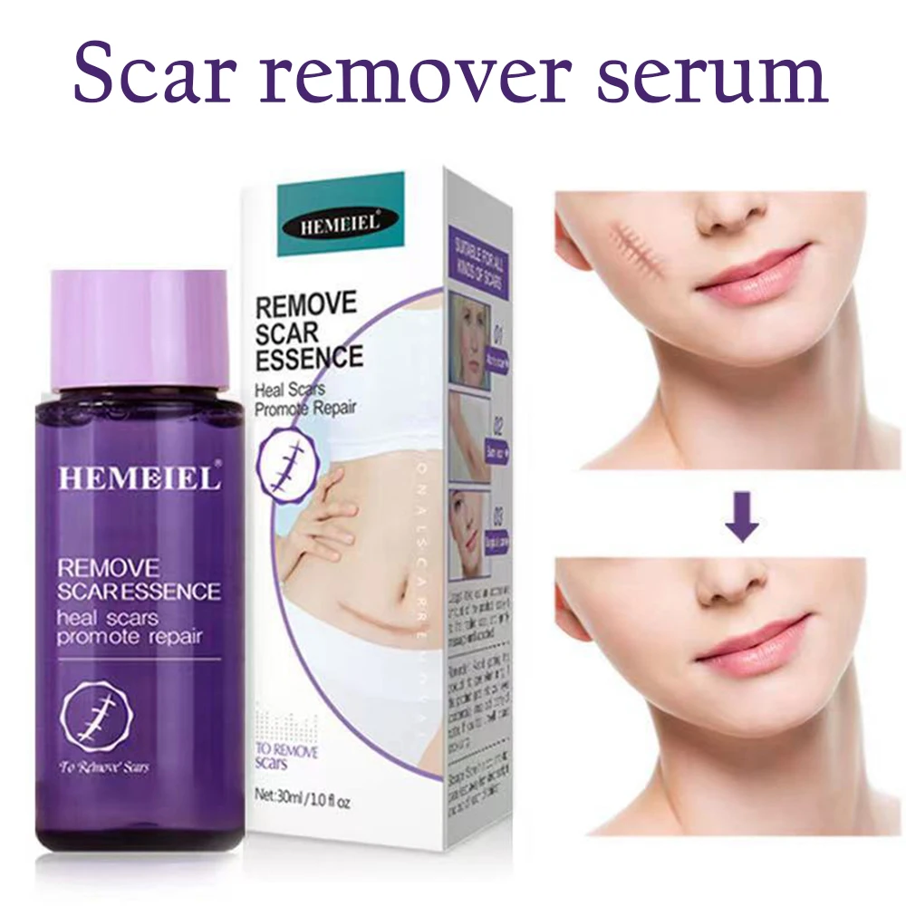 High Quality Scar Removal Serums Post operative Scars Body Smoothing Essential Oils Professional