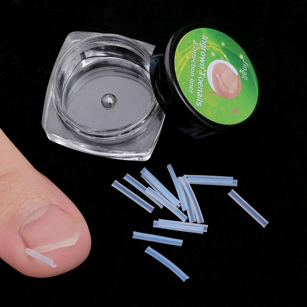 100PCS Toenail Ingrown Corrector Elastic Patches Straightening Clip Tool