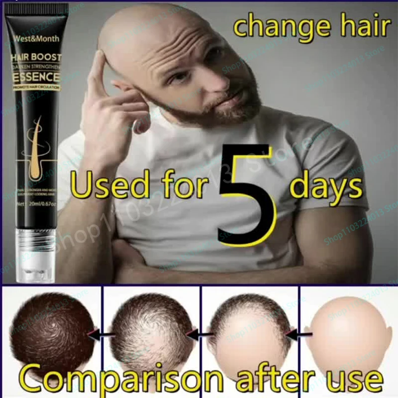 Description Picture 2 of itemAnti Alopecia Fast Hair Growth Oil Ginger Essential Serum Hairless Baldhead Increase High Hairline Natural Head Hair Essence