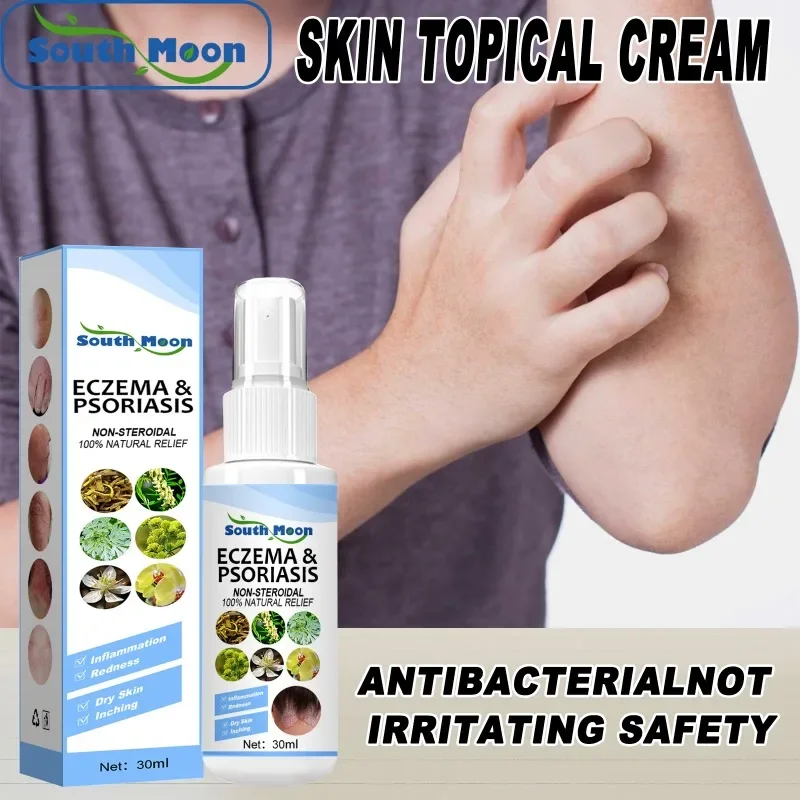 

Psoriasis Essence Spray Relief Itching swell Salicylic Eczema Antipruritic dermatitis relieve Ointment repair Body Skin Care