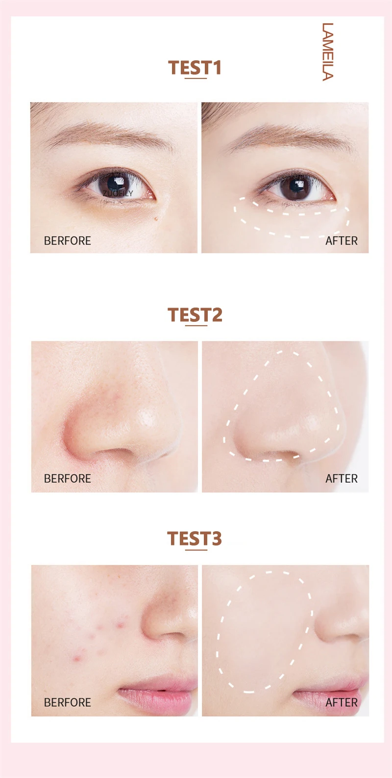 Liquid Concealer For Dark Circles & Pores High Coverage Hydrating_voghion.com