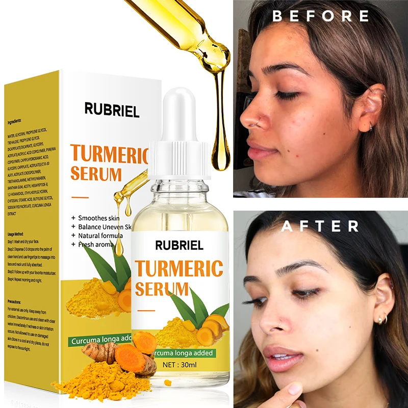 

Куркума сыворотка Отбеливание для удаления темных пятен корректор цвет кожи темные патчи Прыщи против морщин Отбеливание Увлажняющий уход за кожей