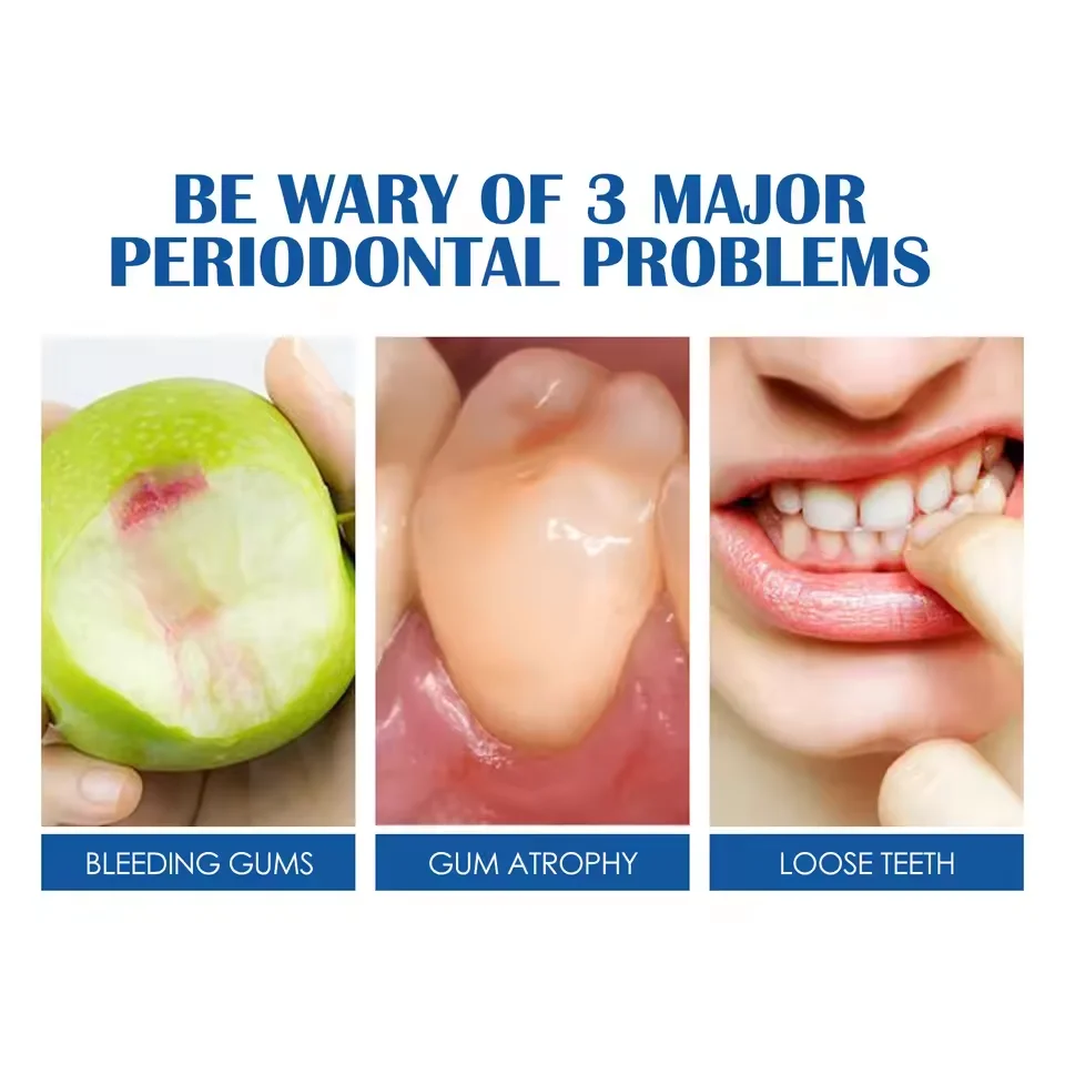 120g Probiotic Caries Toothpaste SP 4 Whitening Tooth Decay Repair Paste Teeth Cleaner Plaque Remover Fresh Breath Dental Care