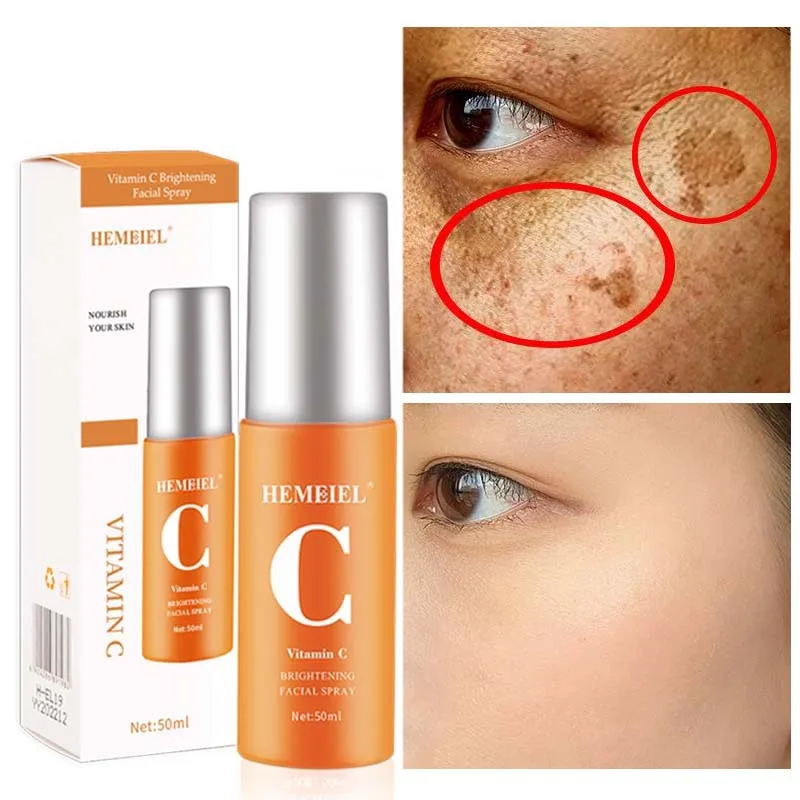 

Vitamin C Whitening Freckle Serum Skin Care Hyaluronic Acid Moisturizing Oil Control Spray Shrink Pores Brighten Repair Cosmetic