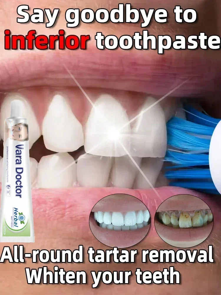 Whitening Toothpaste Dental Calculus Remover Mouth Odor Bad Breath Preventing Periodontitis Oral Care Product teeth whitening product teeth whitening essence dental calculus remover teeth health product