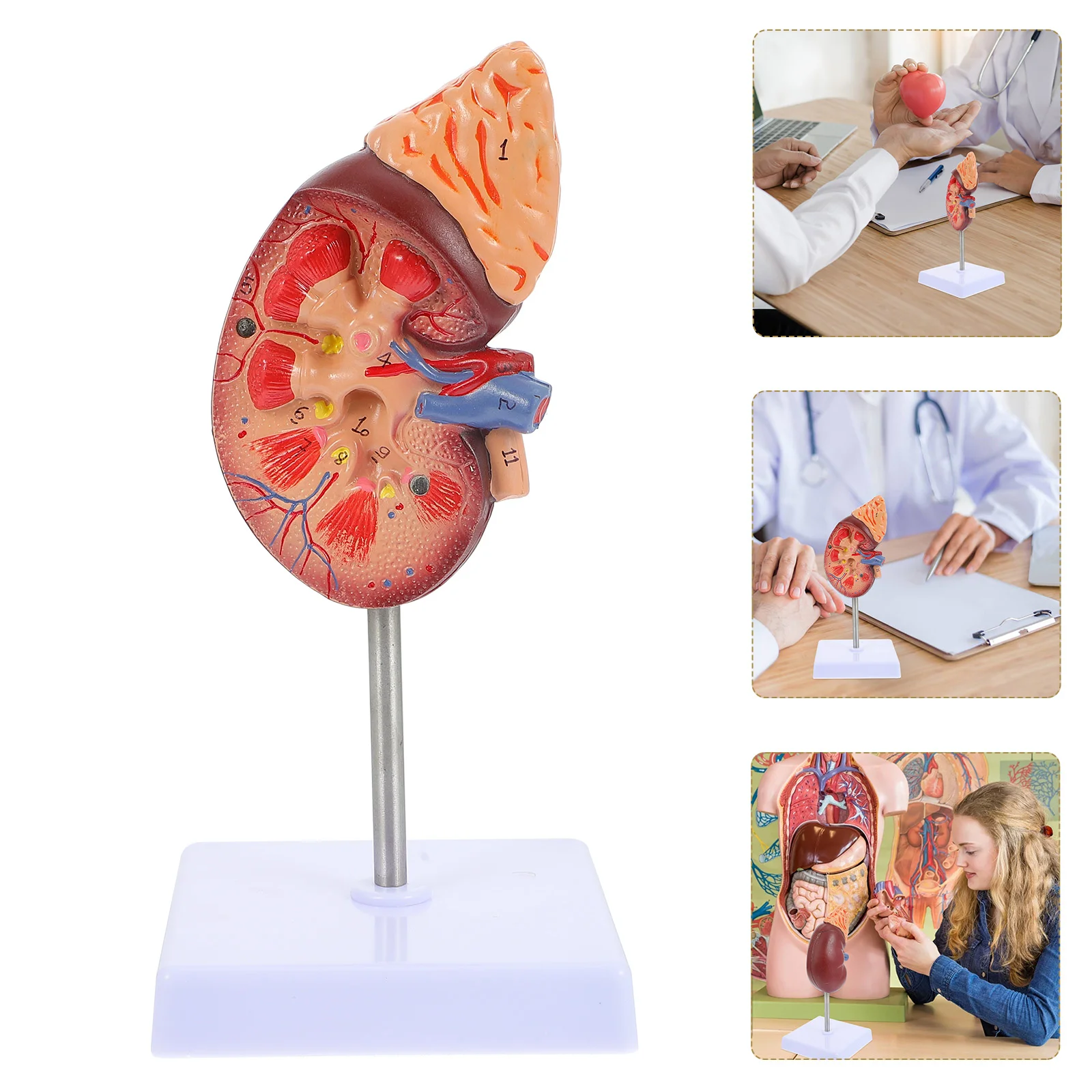 

Models Kidney Biology Demonstration Human Body Anatomical Hume Dissection Class Prop