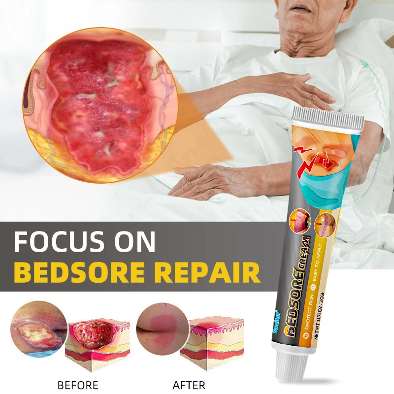 1 Pcs 20g/50g Bed Sorecream Bedsore Ointment Bed Sores Fast Wound Decubitus Ulcer Treatment For Rapid Wound Repair