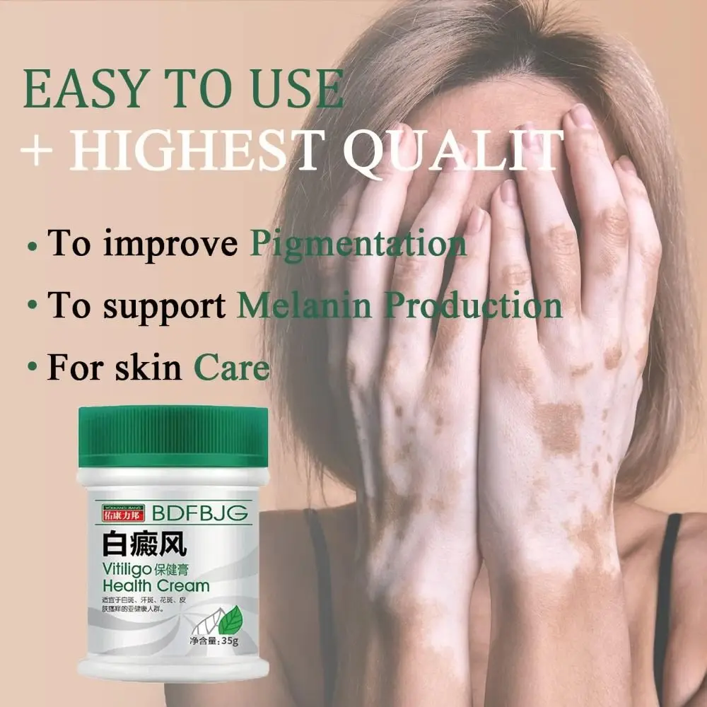 Natural TreatVitiligo Soothing Cream Skin Care Improve Skin Discoloration Vitiligo Care Cream Fast Penetration Fast Soothing