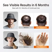 Red Light Therapy Hair Growth Bucket Hat T100 660nm&850nm 336Pcs LED