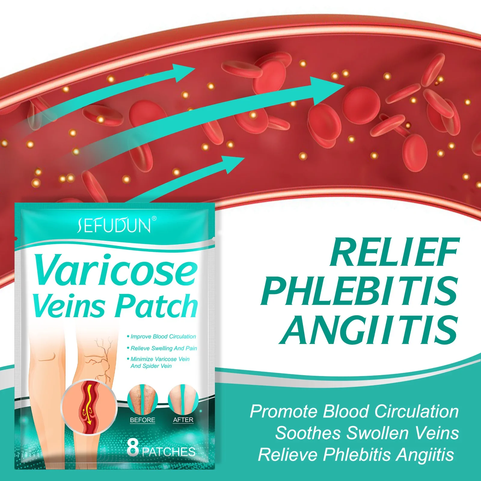 8 PCS Varicose Veins Patch Treatment For Varicose Veins Vasculitis Phlebitis Spider Leg Medical Patch Angiitis Removal