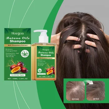 100/300ml Batana Olio e Rosmarino Shampoo Per La Cura Dei Capelli Nutriente Profonda Del Cuoio Capelluto Rimuovere La Forfora Rafforza I Capelli Per Shampoo Lucido Capelli