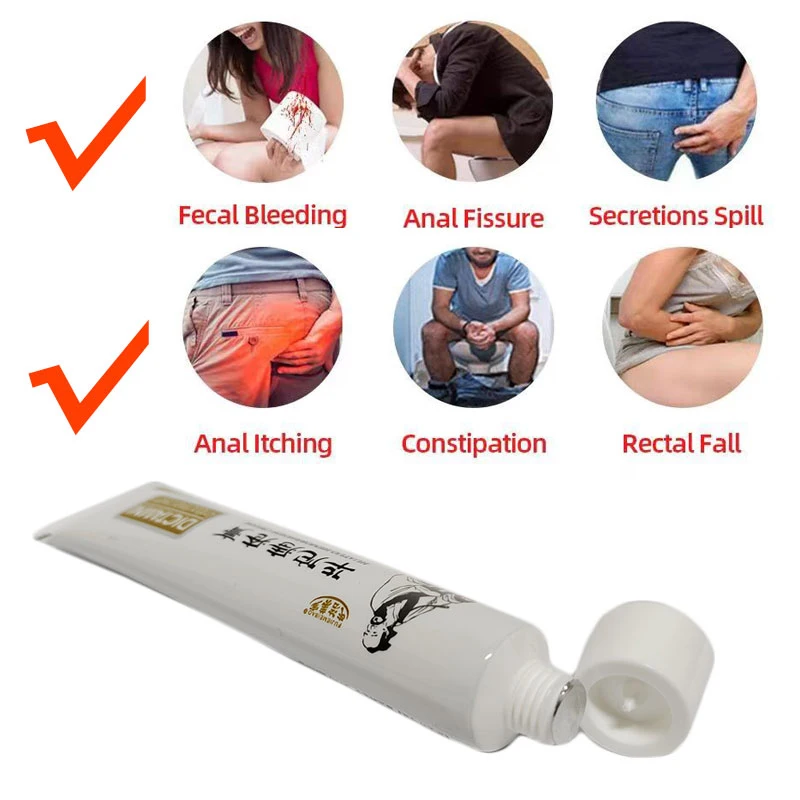 Hemorrhoids Treatment Cream 20g/Box Chinese Huatuo Ointment Herbal Plaster Internal Piles External Anal Fissure