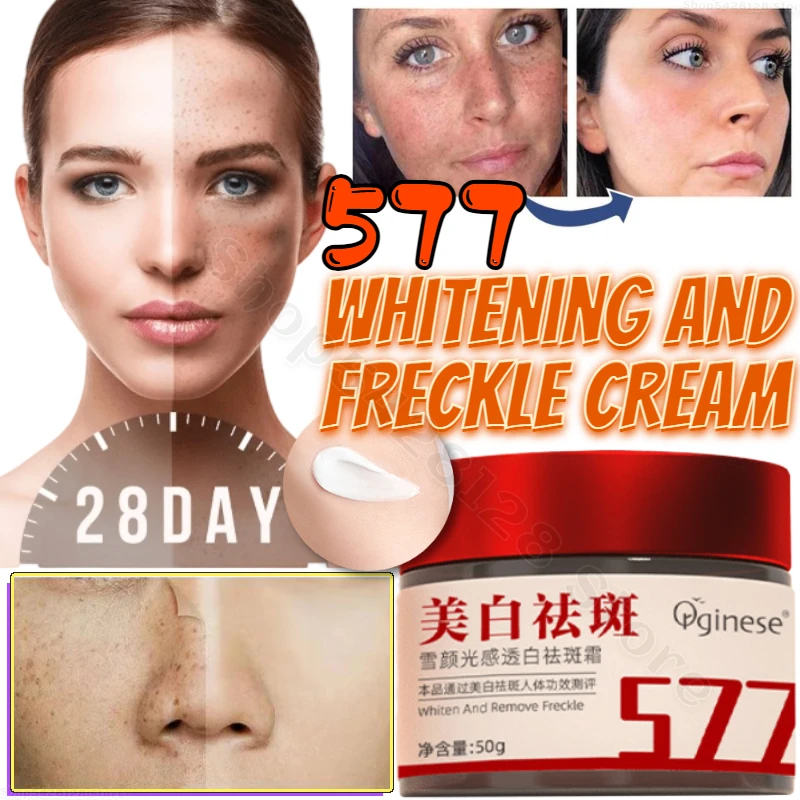 

577 Whitening and Anti-freckle Cream Improves Dullness and Brightens Soft Skin. The Cream Is Light and Non-sticky 50g