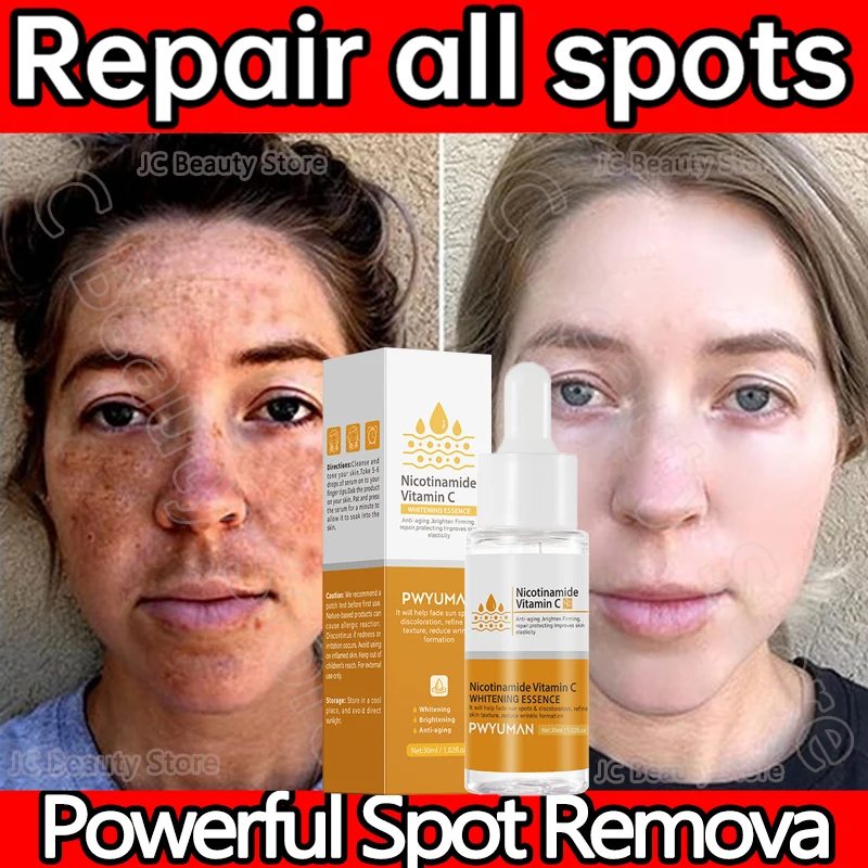 

Whitening Freckle Serum Effective Remove Melasma Essence Cream Fade Dark Spots Pigment Correcting Smooth Face Korean Skin Care