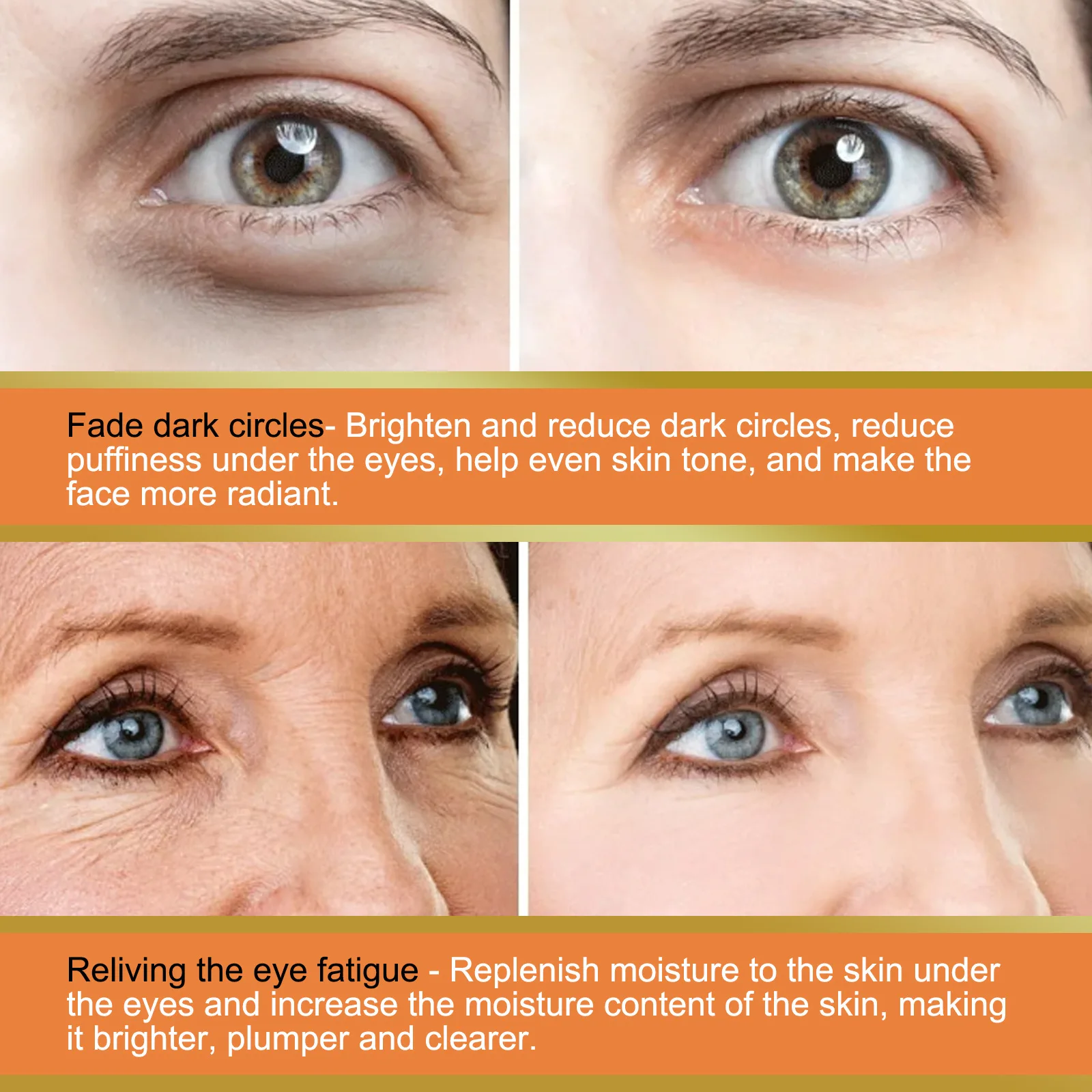 Vitamin C Eye Balm Anti Wrinkle Moisturizing Balm Eye Bag Removal Dark Circles Reduce Fine Lines Smoothing Cream for Women