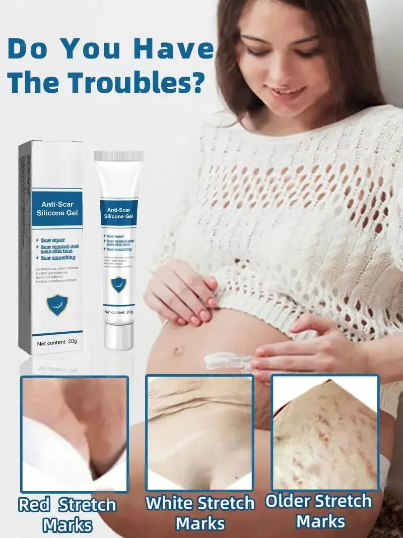 Stretch Marks Cream For Pregnancy Stretch Marks Removal Eliminate Red White Old Stretch Marks Oil
