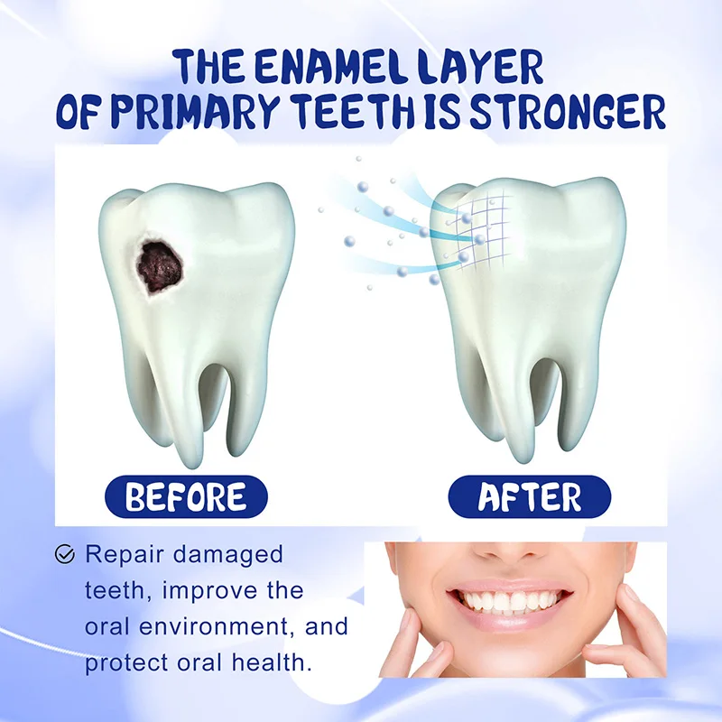 Riparazione della carie dentifricio sbiancante alito cattivo fresco carie Anti-cavità rimuovere la placca mal di denti alleviare la parodontite