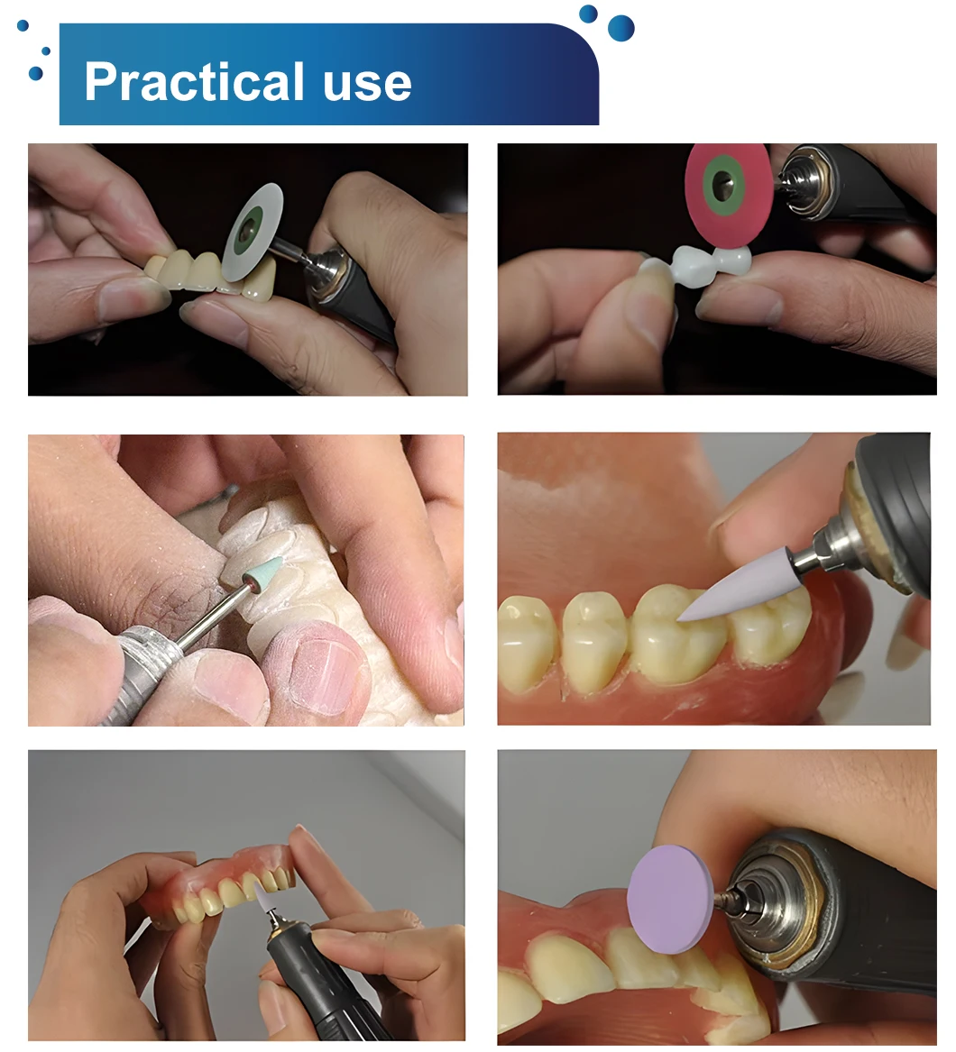 GUSROM 20-teiliges Dental-Zirkonoxid-Polierfräser-Set mit HP-Schaft, Dentallabor-Schleifkit für Emax Keramik, hochpräzise Rotationswerkzeuge – Detail 7