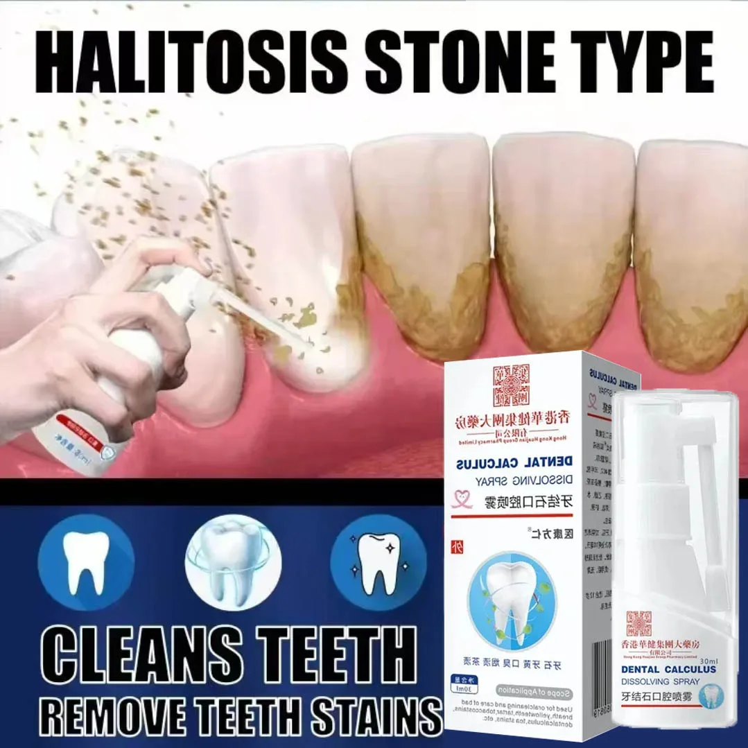 Tooth stone remover,tooth whitening agent,spray,toothpaste book,oral hygiene,halitosis removal,SAF plaque,breath freshening care 1