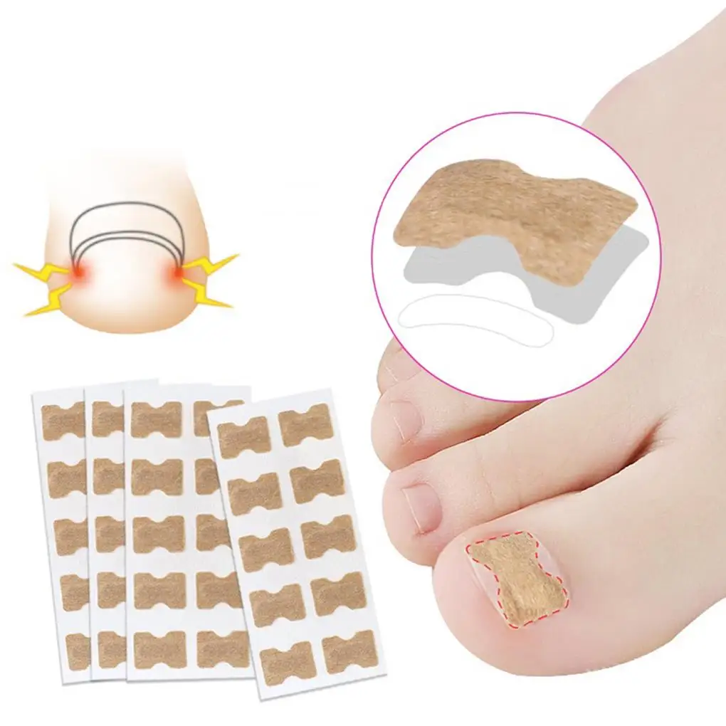 100pcs Ingrown Toenail Corrector Stickers with Double Sided Tape Paronychia Corrector Pedicure Tools