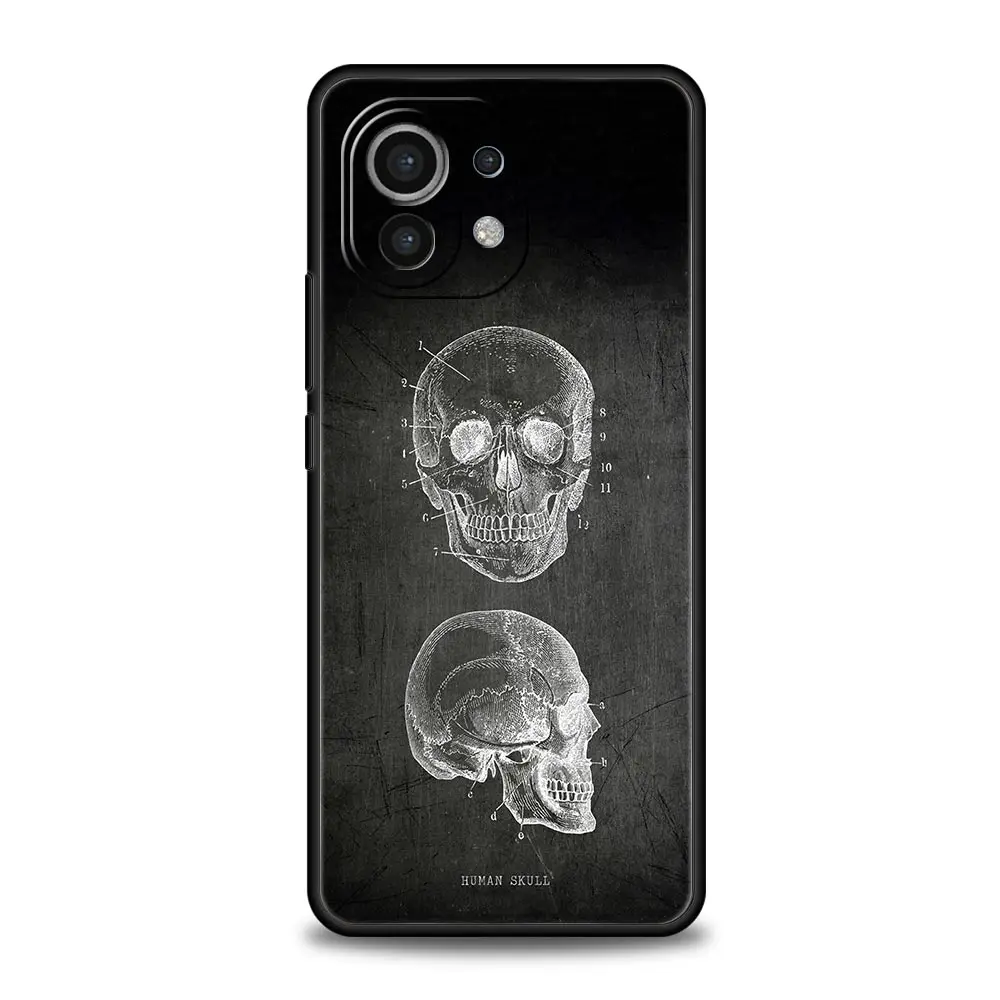 Chalkboard Anatomy Soft Phone Case - Artistic Design Protective Cover