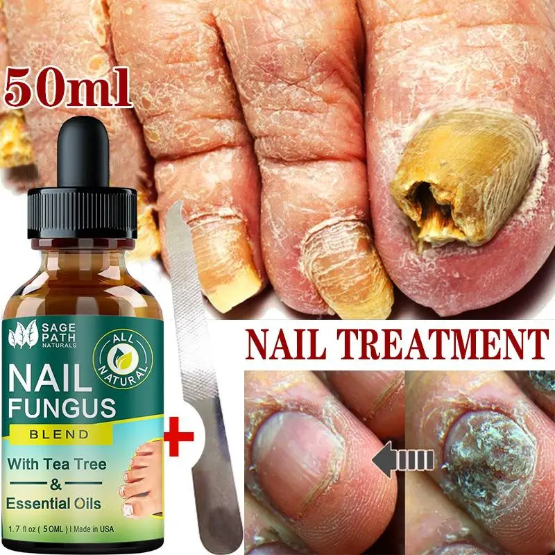 7DAYS Repair Nail Fungus Treatments Essence Foot Care Serum Toe Nails