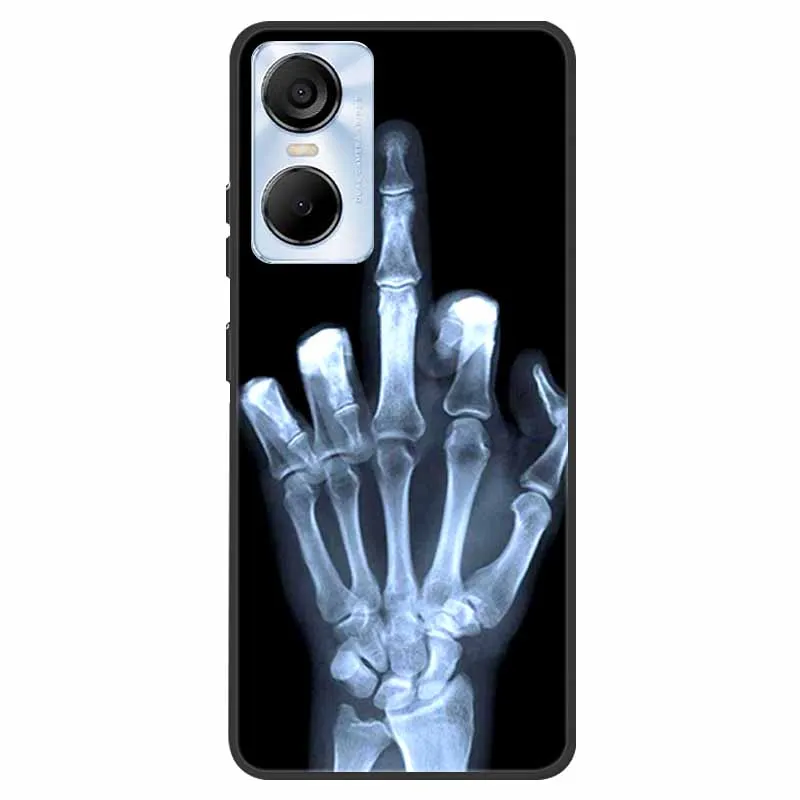 Animal Silicone TPU Soft Phone Case - Protective Wolf & Cat Design