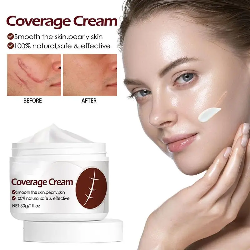 Scar Cream For Old Scars 30g Effective Cream For Scars Natural Scar Remover Healing Body Cream For Burn Scars Body