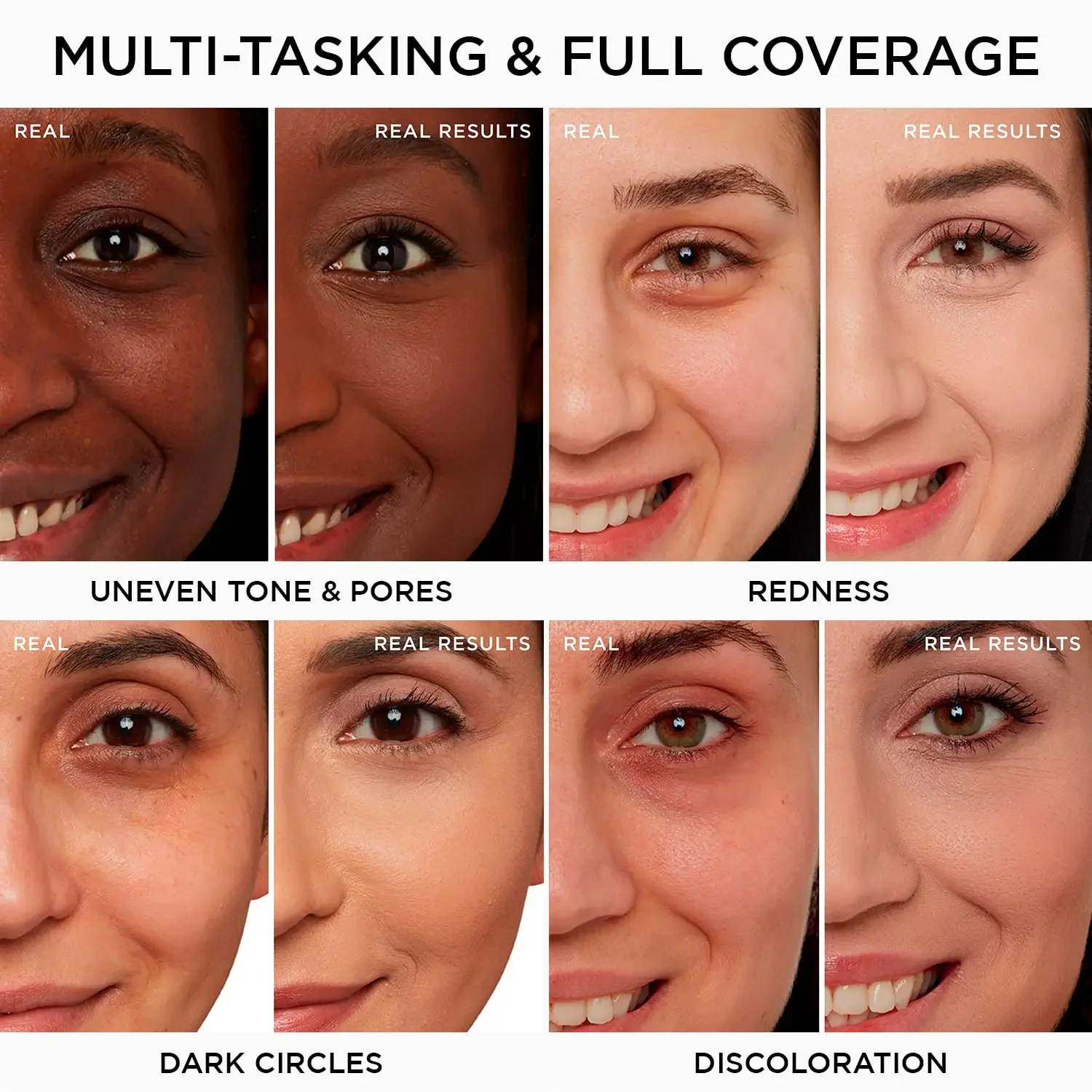 Foreverkey Concealer Foundation Makeup For Dark Eye Circles Pimple Mark Long Lasting Smooth ALWAYS STAND BY Concealer Cream