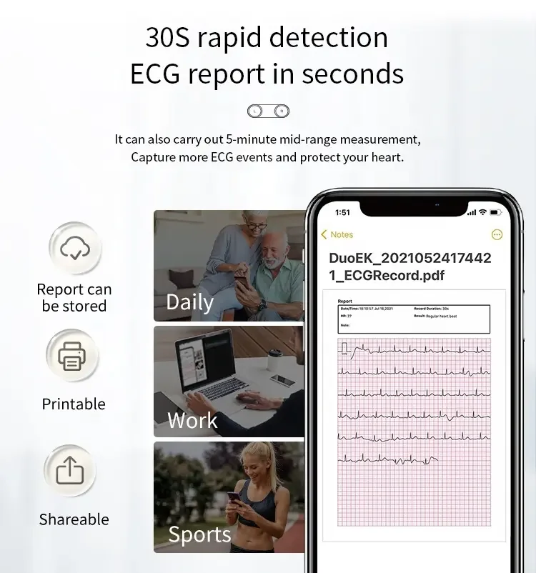ER2 Portable ECG Monitor OLED Multiple Measurement Methods For Fast Measurement of Heart Rate Monitoring Unlimited Data Storage