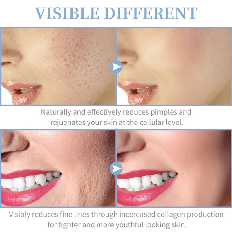 4 IN 1 Facial Beauty Machine High Frequency  Electrotherapy Wand Neon + Argon Wands Remove wrinkles Inflammation Acne Skin Care 6