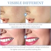 4 IN 1 Facial Beauty Machine High Frequency  Electrotherapy Wand Neon + Argon Wands Remove wrinkles Inflammation Acne Skin Care 6