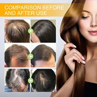 Biotine produits de croissance rapide des cheveux Anti perte de cheveux sérum Spray prévenir la calvitie traitement cuir chevelu barbe beauté produit de soin des cheveux 4
