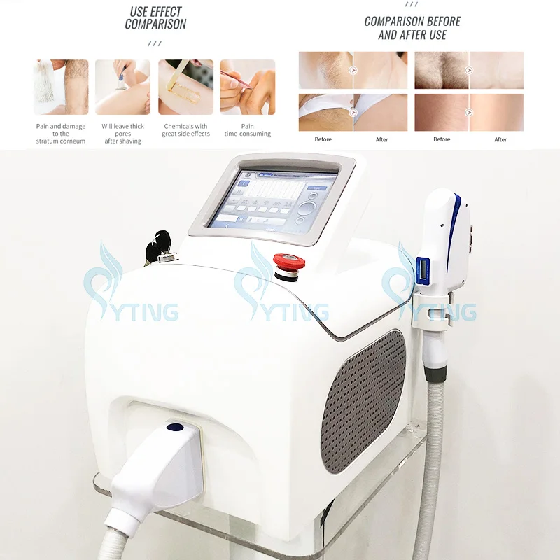 

OPT IPL Hair Removal DPL Laser Machine Skin Care Vascular Freckle Acne Removing Device Powerful Beauty Equipment