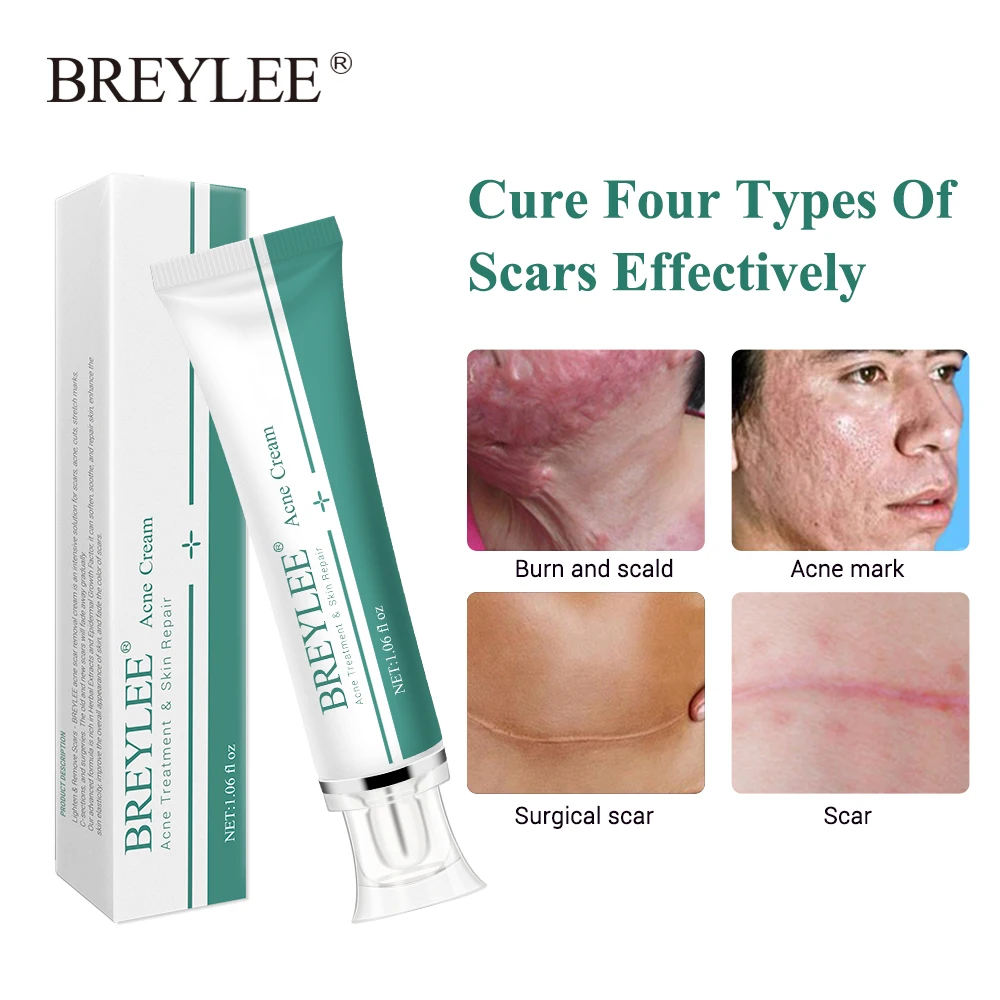 Scar Removal Cream Stretch Marks Acne Scars Skin Repair Dark Spot Remover Face Skin Care face cream,skin cream