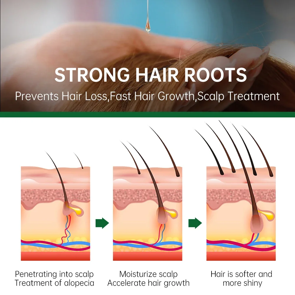 PURC Rosemary Oil for Hair Growth Men Women Scalp Treatment Anti Hair Loss Essential Fast Grow Oil Care Beauty Health 50ml,hair growth serum,hair growth spray,hair care oil,hair growth cream,hair growth shampoo set