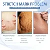 44716-1f81ee.jpg Stretch Mark Repair Cream – Firm, Smooth & Restore Skin
