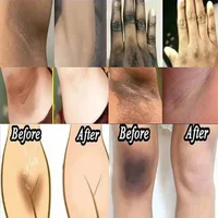 Crème éclaircissante à la nicotinamide pour peau foncée, efficace, éclaircir l'intérieur de la cuisse Wiltshire ach, enlever la mélanine, parties intimes, éclaircir 2