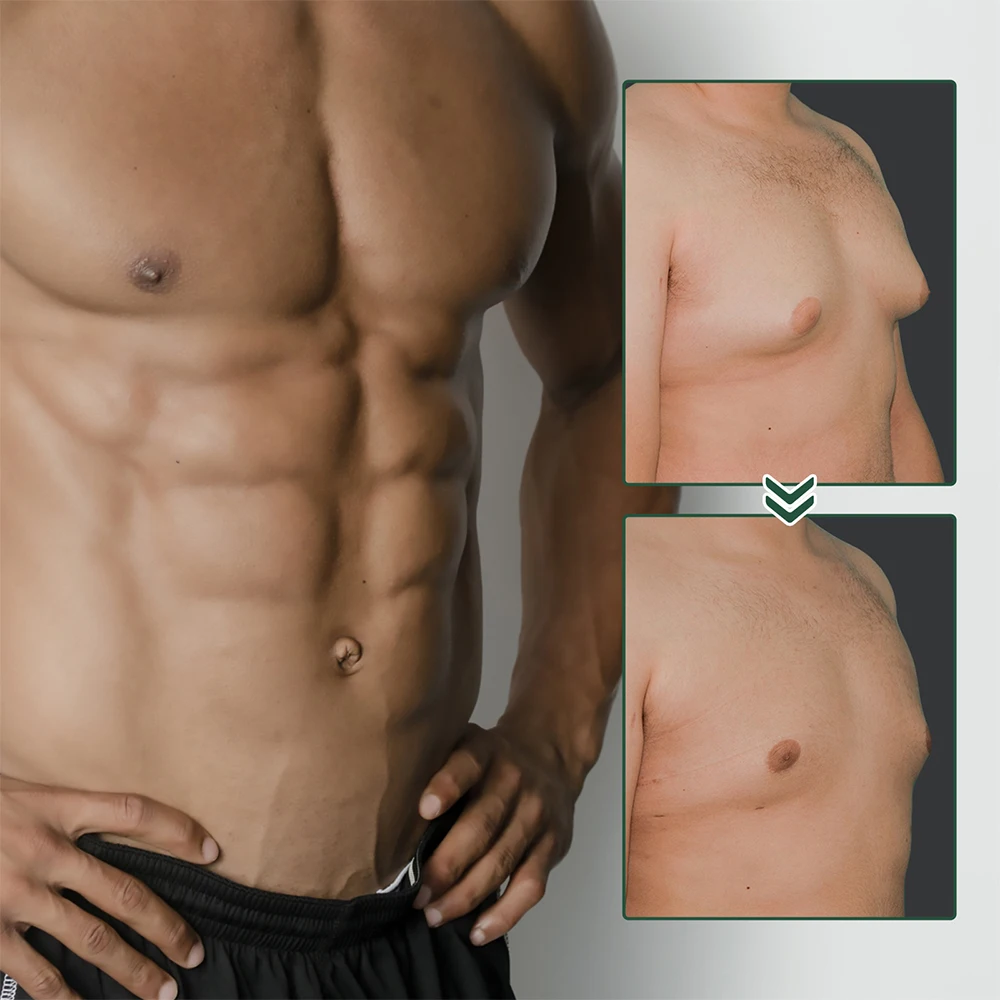 Breast Enlargement Cream Weight Loss Cream Man Breast Firm Massage Ginger Serum Remove Excess Fat Shrink Chest Gynecomastia Tighten 30ml