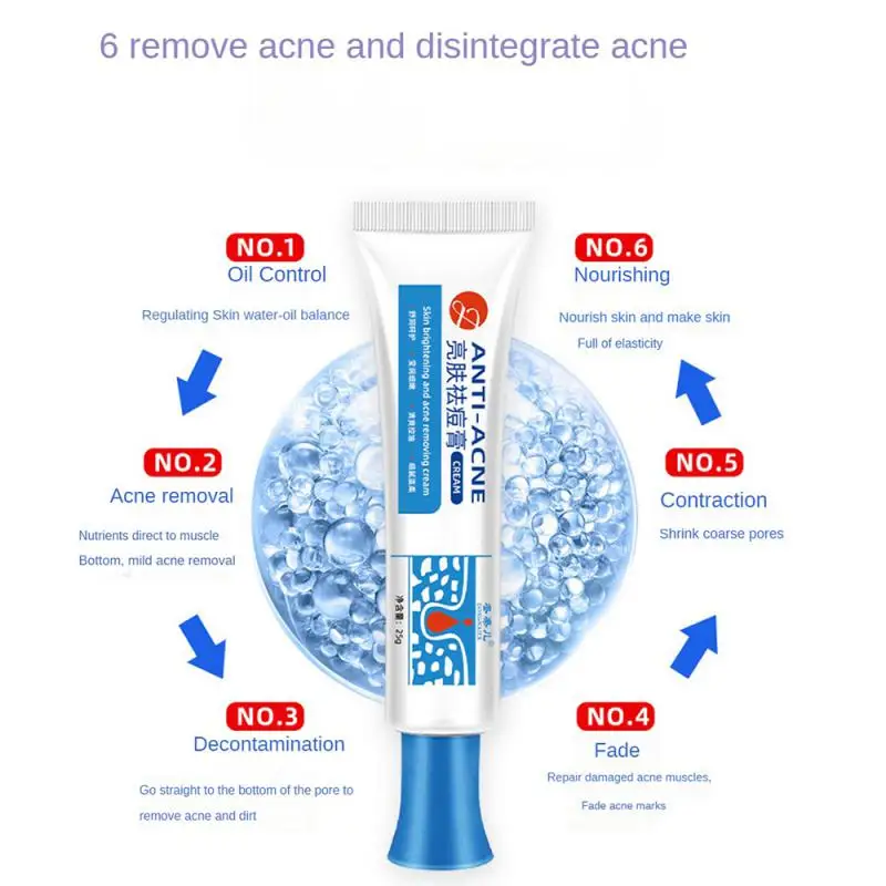 25g Acne Removal Face Cream Natural Acne Beauty Health Anti-acne Gel Pimple Spot Removal Skin Care Mild