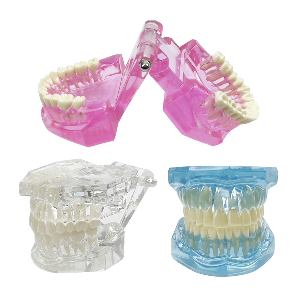 Advanced Dental Anatomy Teaching Model for Educational Demonstration